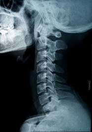 Anatomy cervical spine 2a