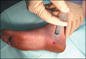 foot pain injection